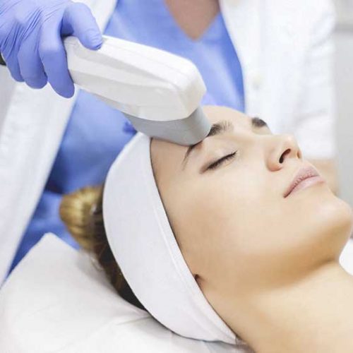 1586-IPL_Treatment-732x549-thumbnail