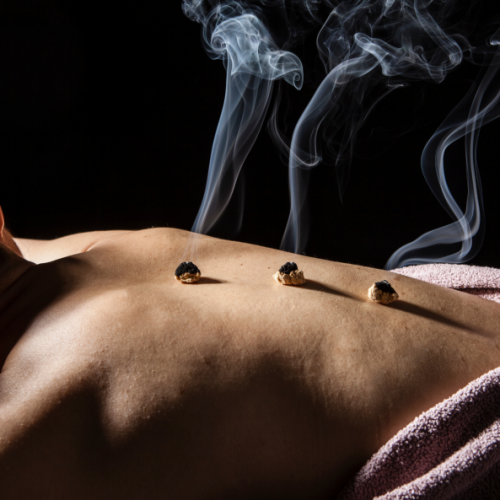 Moxibustion-3-768x593