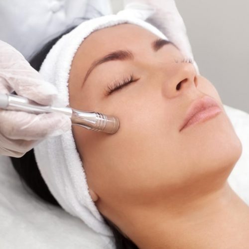 microdermabrasion microdermabrasion